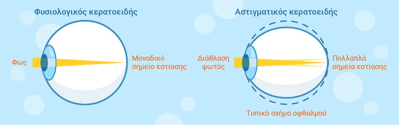 τυπικός και αστιγματικός κερατοειδής